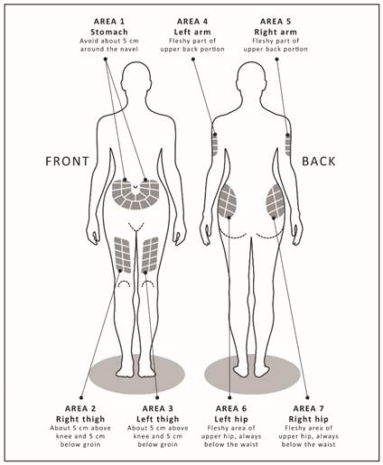 Description: Description: ILL INJECTION SITES FIG1